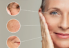 “To Tighten Skin, Should You Invest in a Wrinkle-Reducing Device or Focus on Collagen Supplements?”