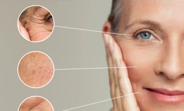 “To Tighten Skin, Should You Invest in a Wrinkle-Reducing Device or Focus on Collagen Supplements?”