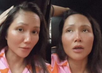 “H’Hen Niê’s Hair Loss: Stress-induced Hair Shedding and Solutions”