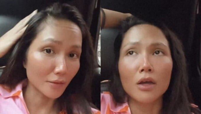 “H’Hen Niê’s Hair Loss: Stress-induced Hair Shedding and Solutions”