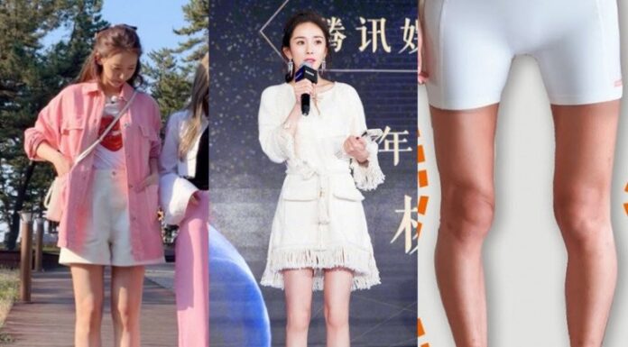 “How to Dress to Flatter Your Knock Knees: 5 Stylish Ways to Appear Straighter”