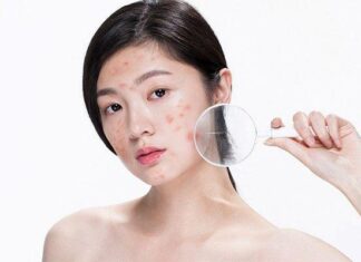 “5 Super Ingredients to Banish Skin Blemishes: Achieve Flawless Skin Without the Spa Price Tag”