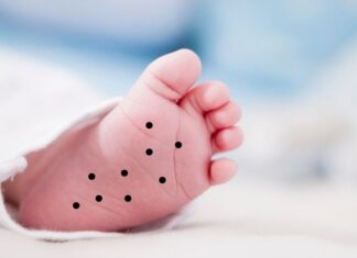 The Lucky Mole: A Sign of Prosperity and Wealth for Men and Women Alike