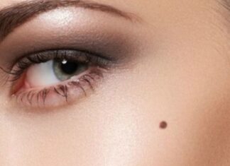 The Four Lucky Moles on Your Face: A Fortunate Few.