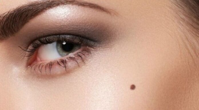 The Four Lucky Moles on Your Face: A Fortunate Few.