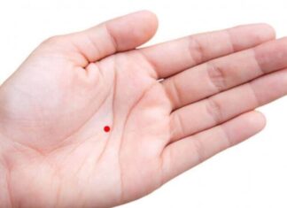 The Lucky Mole: A Symbol of Everlasting Love and Marital Bliss