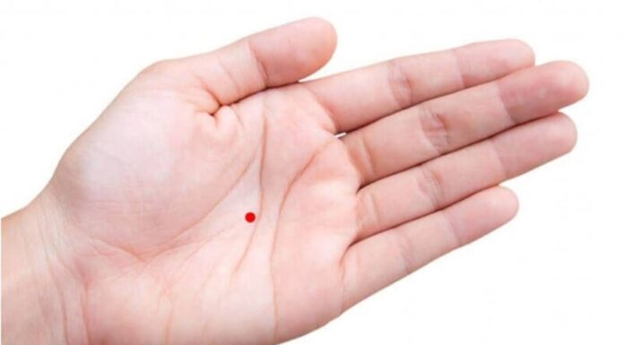 The Lucky Mole: A Symbol of Everlasting Love and Marital Bliss