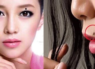 The Lucky Four: Moles to Keep, Fortune to Embrace