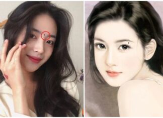 The Mole on the Face Brings Fortune: A Sign of Wealth for Those Who Bear It