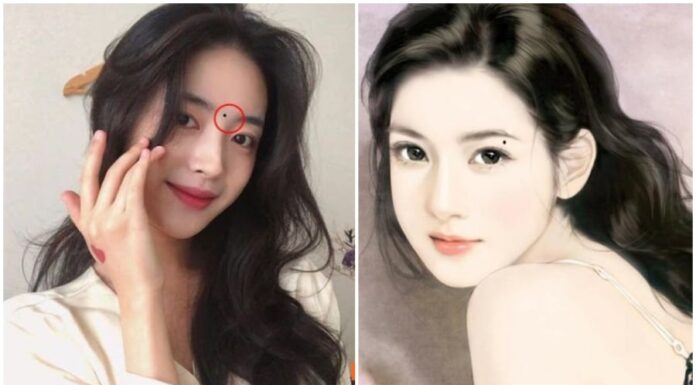 The Mole on the Face Brings Fortune: A Sign of Wealth for Those Who Bear It