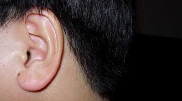 The 9 Moles That Attract Wealth and Fortune: A Lucky Sign That Brings Prosperity