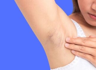 The Ultimate Guide to Underarm Darkness: 5 Simple Strategies for Brighter Skin