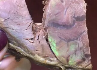 Is the Iridescent Beef Truly Dangerous?