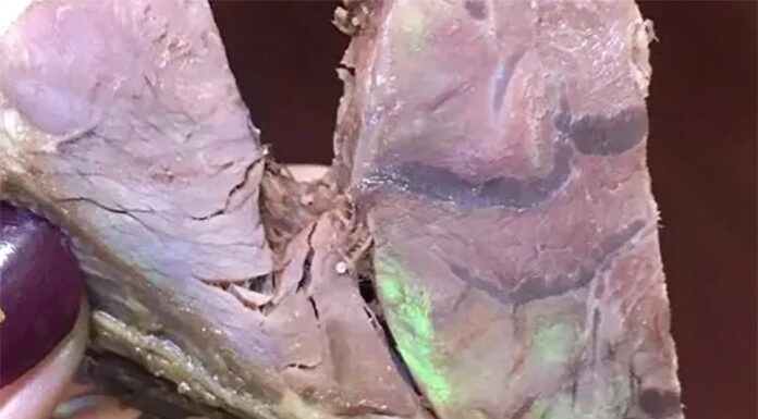 Is the Iridescent Beef Truly Dangerous?