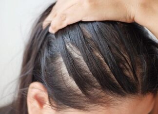 The Secret to Bidding Farewell to Hair Fall During Seasonal Changes