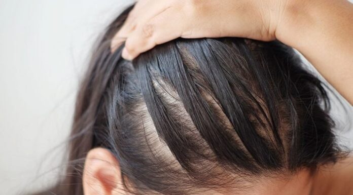 The Secret to Bidding Farewell to Hair Fall During Seasonal Changes