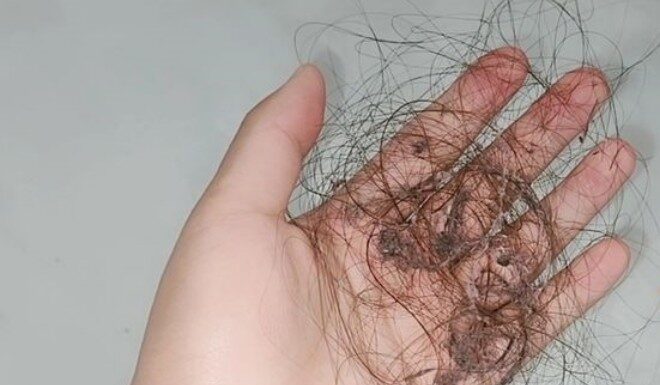 The Hair Shedding Struggle: 10 Easy Tips to Keep Your Home Hair-Free