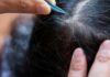 What Are the Consequences of the Hair-Pulling Habit on Your Scalp and Hair?