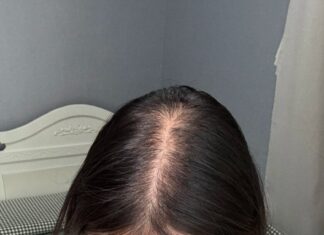 “Flat and Thin Hair: 3 Instant Volumizing Tricks for a Luscious, Full-Bodied Look”