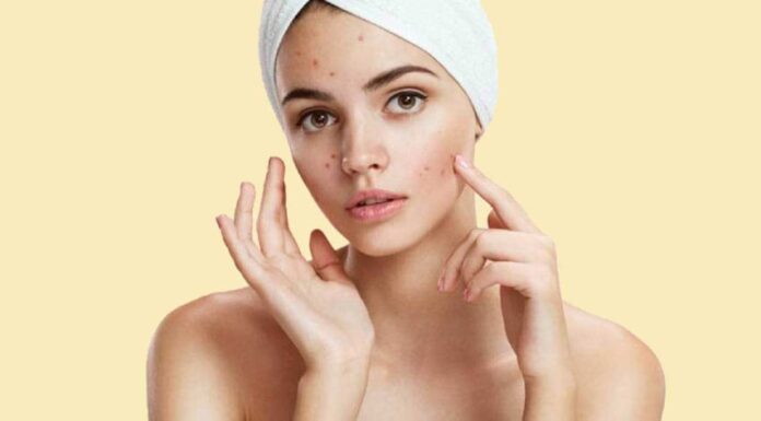 7 Skin Care Mistakes That Are Making Your Acne Worse and Damaging Your Skin