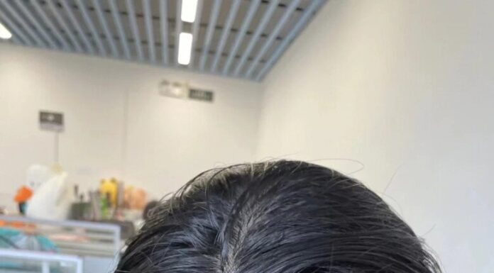 “Oil-Busting, Style-Sustaining: 4 Hairdos and 6 Care Tips for Greasy-Locked Girls”