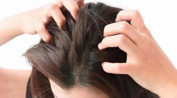 The Ultimate Guide to Scalp Care: Say Goodbye to Itch and Flakes