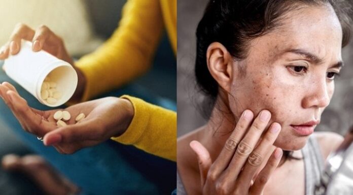 Why Do Experts Advise Against Taking Vitamin C for Skin Whitening?