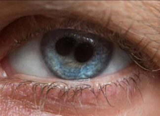 The Eight Individuals with ‘Double Pupils’ in History: Saints and Emperors Alike