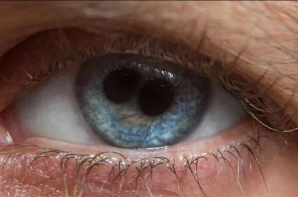 The Eight Individuals with ‘Double Pupils’ in History: Saints and Emperors Alike