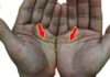 The Four ‘Ugly’ Palm Lines: What They Mean and How They Reflect Your Fortune