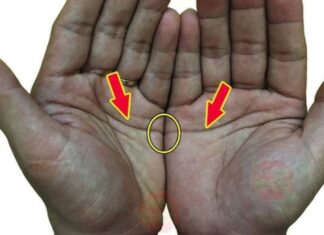 The Four ‘Ugly’ Palm Lines: What They Mean and How They Reflect Your Fortune