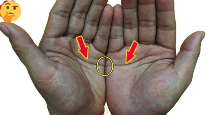 The Four ‘Ugly’ Palm Lines: What They Mean and How They Reflect Your Fortune