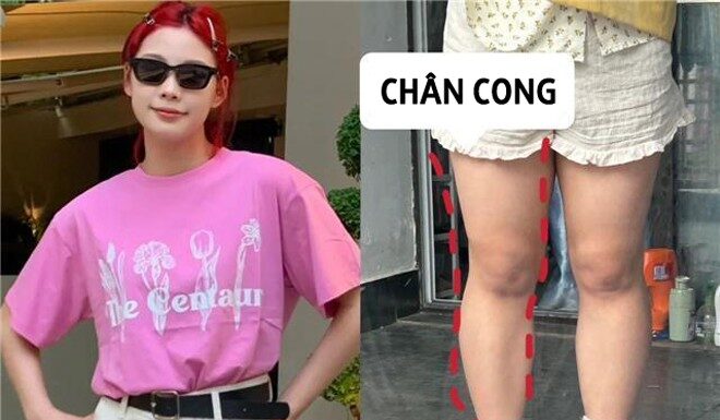 The Ultimate Guide to Summer Styling: Why Long Trousers are the New Cool