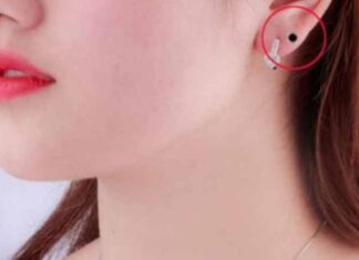 Is the Mole on Your Earlobe a Sign of Good Fortune?