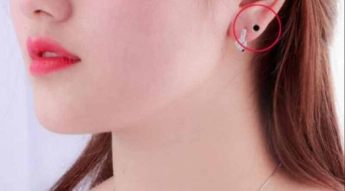 Is the Mole on Your Earlobe a Sign of Good Fortune?