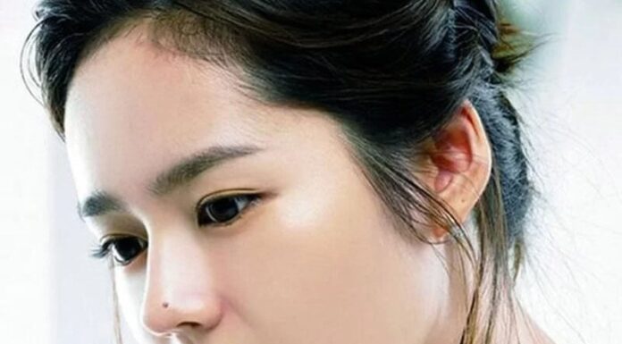 The Lucky Trio: Embrace These 3 Moles on Your Body for Unceasing Wealth