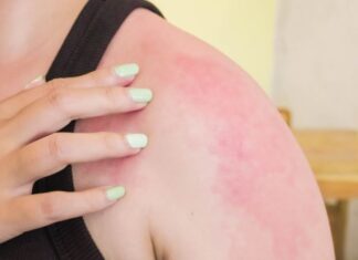 “Soothe Your Skin: The Post-Sun Exposure Ritual You Need”