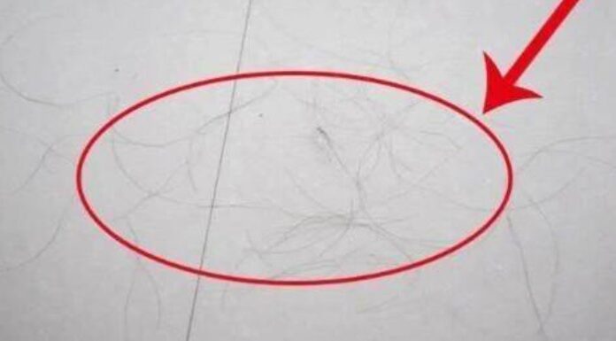 “A Simple Solution to a Hairy Problem: Sweep Away Those Strands”