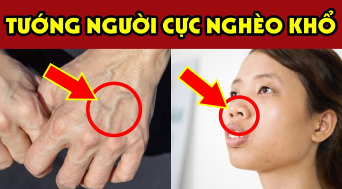 Title: A Fortunate Few: The Mark of a Silver-Lined Destiny