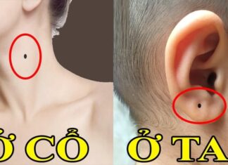 The Four Moles Worth More Than Gold: How Your Child’s Beauty Marks Can Bring Blessings and Fortune