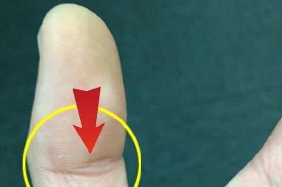 The Luckiest of Them All: An Extraordinary Life of Good Fortune and Blessings Unfolds for the Owner of This Fingerprint