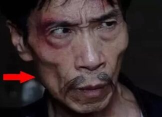 Why You Should Avoid Those With Sunken Cheeks, According to the Elders