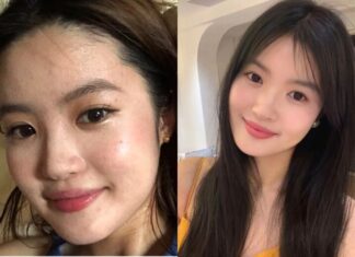 The Chinese Girl Who Lost 17kg by Cutting Out Sugar