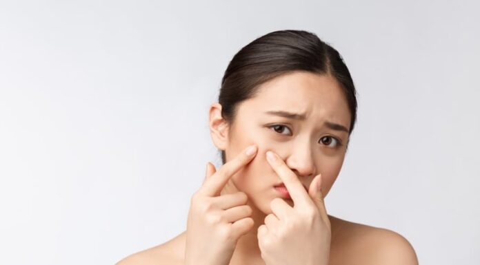 The Ultimate Guide to Acne-Fighting Face Masks: 9 Powerful Recipes for Clear, Glowing Skin