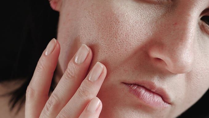 Rescue Your Skin from Winter’s Chill with These Tips and Tricks