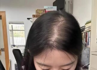 The Hair-Raising Truth: Is Your Scalp Screaming for a Wash?