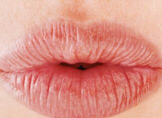 The Ultimate Guide to Luscious Lips: 4 Simple Steps to Baby-Soft Pout