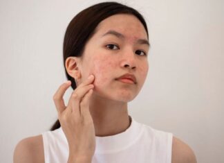 The 6 Main Culprits Behind Your Skin’s Woes