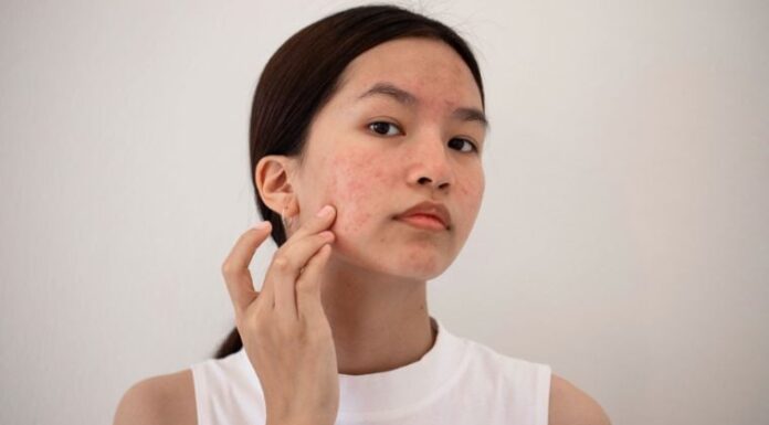 The 6 Main Culprits Behind Your Skin’s Woes