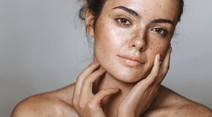 The Real Reason Behind Skin Pigmentation Relapse and Easy Solutions Every Woman Should Know About